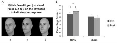 Using High Frequency Transcranial Random Noise Stimulation to Modulate Face Memory Performance in Younger and Older Adults: Lessons Learnt From Mixed Findings